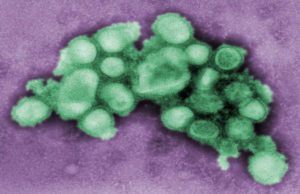 Is Influenza a deadly virus? Influenza